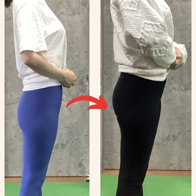 40代女性のBefore(左)とAfter(右)の比較写真。ヒップアップと太もも-3cmを達成した事例。