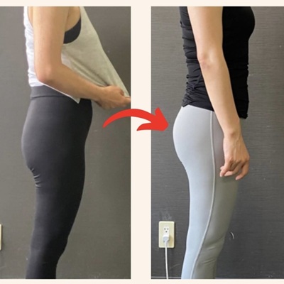 40代女性のBefore（左）とAfter（右）の比較写真。会社の同僚からも変化を褒められた事例。