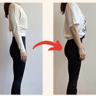 40代女性のBefore（左）とAfter（右）の比較写真。お尻に丸みが出て形が綺麗になった事例。